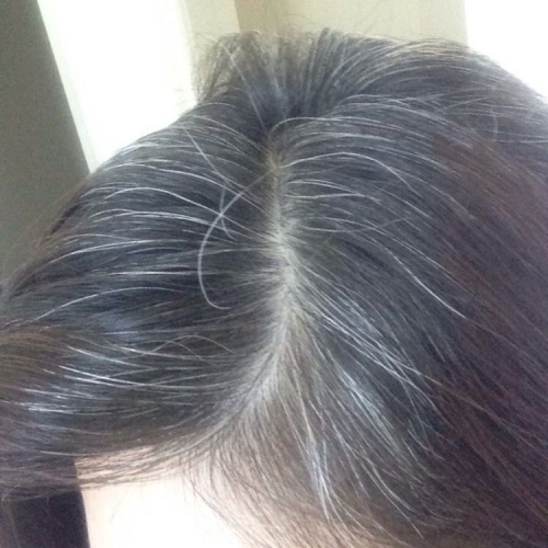 髪の毛が白髪になる原因